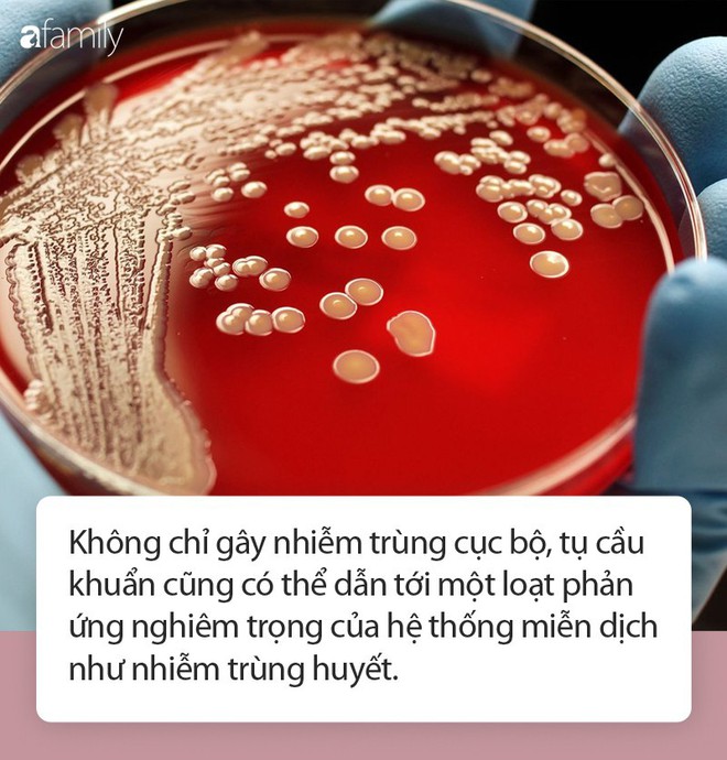 Dấu hiệu nhiễm trùng tụ cầu khuẩn bất kì ai cũng không được bỏ qua - Ảnh 1.