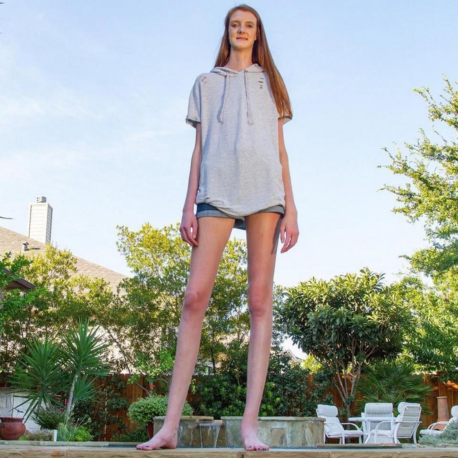 Cô gái mới 16 tuổi đã sở hữu chiều cao khủng, đôi chân dài kỷ lục ...