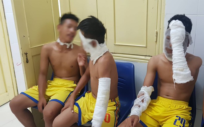Chùm bóng bay phát nổ, 3 cầu thủ U14 Sông Lam Nghệ An nhập viện - Ảnh 1.