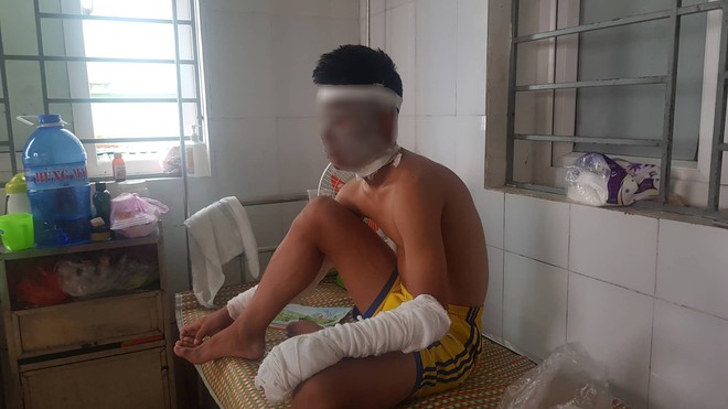 Chùm bóng bay phát nổ, 3 cầu thủ U14 Sông Lam Nghệ An nhập viện - Ảnh 2.
