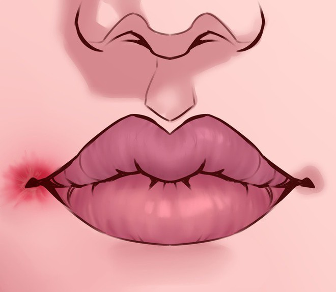 8 điều mà đôi môi đang ngầm cảnh báo sức khỏe của bạn không ổn chút nào - Ảnh 1.