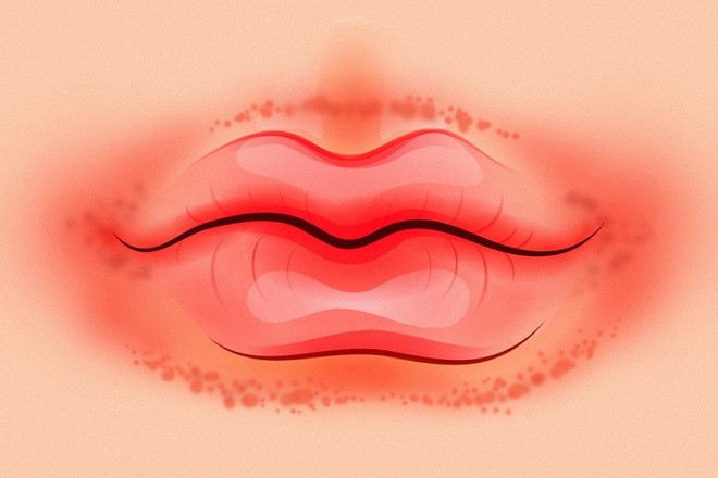 8 điều mà đôi môi đang ngầm cảnh báo sức khỏe của bạn không ổn chút nào - Ảnh 4.