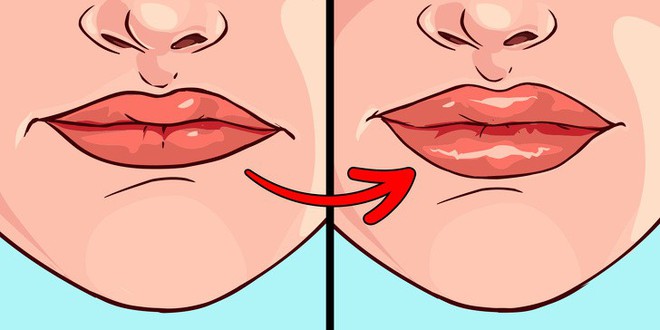 8 điều mà đôi môi đang ngầm cảnh báo sức khỏe của bạn không ổn chút nào - Ảnh 7.
