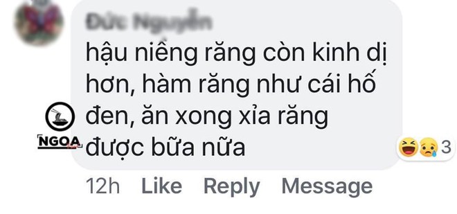 Trần đời ai oán chỉ có hội “đồng niềng” mới hiểu được những nỗi khổ ăn uống khi niềng răng, không cẩn thận còn bay luôn cả “chục củ” - Ảnh 14.