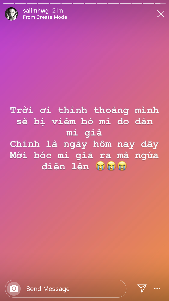 Viêm bờ mi là tình trạng như thế nào mà khiến Salim ngứa điên lên khi bóc mi giả? - Ảnh 2.