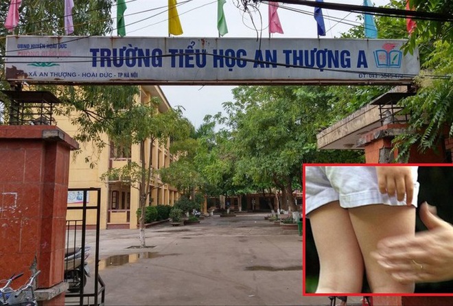 Đề xuất tiêm thuốc đối với yêu râu xanh xâm hại trẻ em - Ảnh 1.