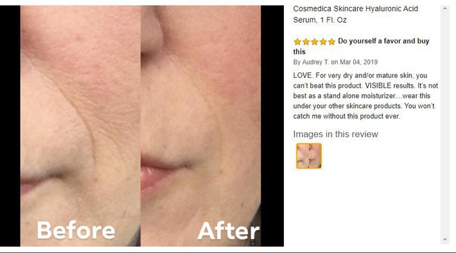 Serum bán chạy trên Amazon: Chỉ hơn 200k mà giúp mờ nếp nhăn thấy rõ  - Ảnh 2.