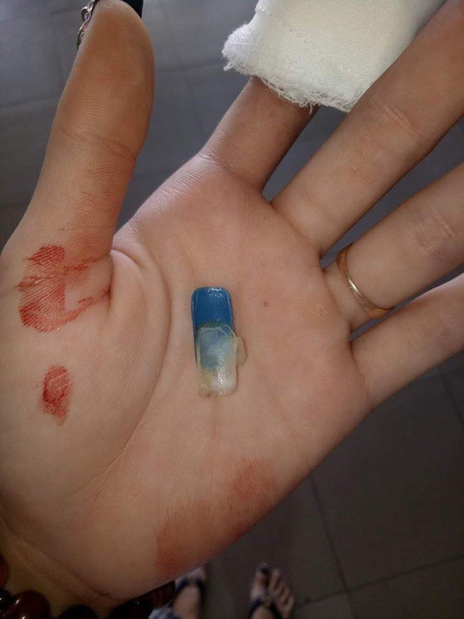 Mới đầu năm đã “toang” cả móng thật lẫn móng giả, chuyên gia lưu ý tới các chị em có thú vui làm nail - Ảnh 1.