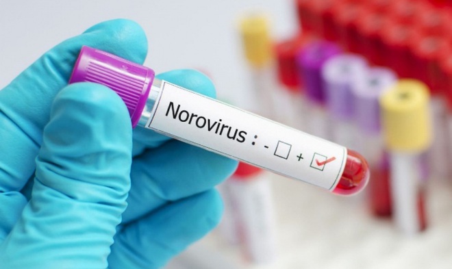 Trung Quốc: Hơn 70 sinh vi&ecirc;n nghi nhiễm norovirus - Ảnh 1.