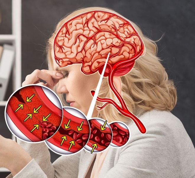 Thời tiết u ám cũng có thể gây ảnh hưởng tới sức khỏe của bạn và đây là 6 vấn đề mà bạn có nguy cơ gặp phải - Ảnh 5. Thời tiết u ám cũng có thể gây ảnh hưởng tới sức khỏe của bạn và đây là 6 vấn đề mà bạn có nguy cơ gặp phải - Ảnh 5.