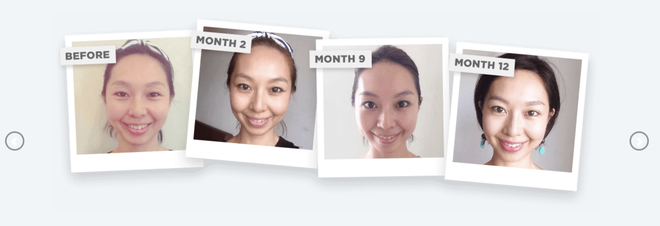 Chị em thi nhau tập yoga cho mặt, liệu ph&aacute;p nghe lạ tai nhưng ai &aacute;p dụng cũng c&oacute; hiệu quả như ti&ecirc;m filler, botox - Ảnh 7.