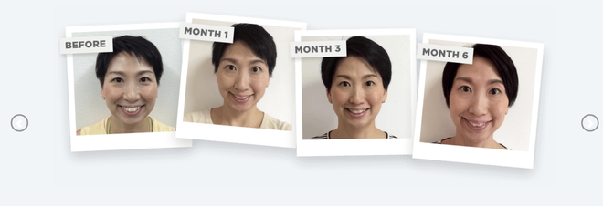 Chị em thi nhau tập yoga cho mặt, liệu ph&aacute;p nghe lạ tai nhưng ai &aacute;p dụng cũng c&oacute; hiệu quả như ti&ecirc;m filler, botox - Ảnh 8.