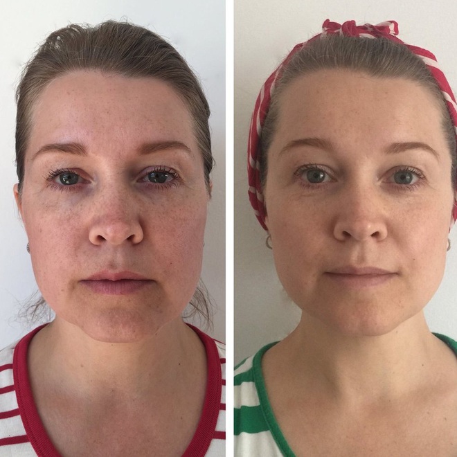 Chị em thi nhau tập yoga cho mặt, liệu ph&aacute;p nghe lạ tai nhưng ai &aacute;p dụng cũng c&oacute; hiệu quả như ti&ecirc;m filler, botox - Ảnh 3.