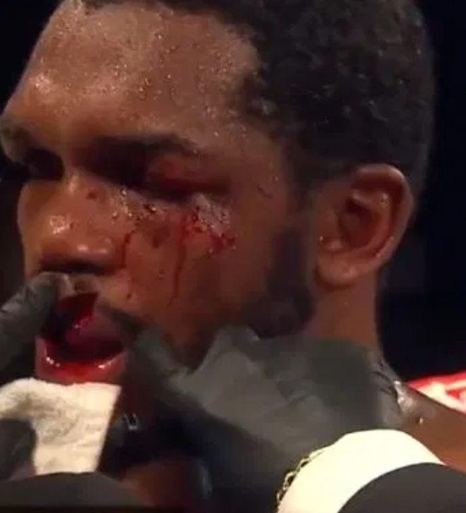 Đang thi đấu tay đấm bỗng bị trọng t&agrave;i dắt ra gặp b&aacute;c sĩ, kiểm tra th&igrave; ph&aacute;t hiện ra m&ocirc;i bị r&aacute;ch đ&ocirc;i đến kinh ho&agrave;ng - Ảnh 3.