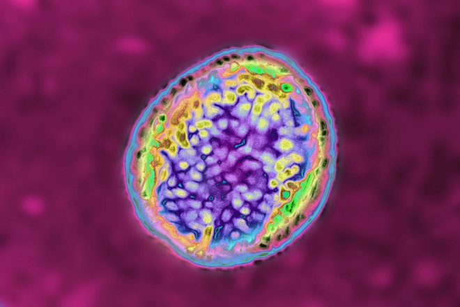 Hơn 6.600 người ở Trung Quốc mắc bệnh Brucellosis - Ảnh 1.