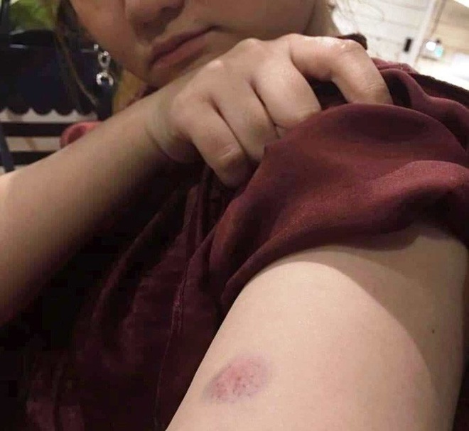 Tranh giành chỗ chụp hình ở hồ Vô Cực - Đà Lạt, một du khách Thái Lan bị đánh bầm dập - Ảnh 3.