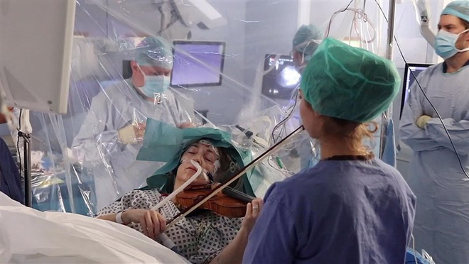 Tỉnh bơ gảy đàn violin khi bác sĩ đang phẫu thuật não, bệnh nhân này đã chứng minh phim ảnh không hề giỡn chơi - Ảnh 2.