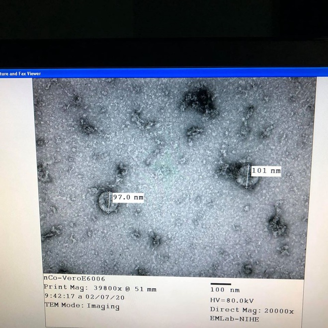 Tin vui: Việt Nam nuôi cấy và phân lập thành công virus Corona mới - Ảnh 1.