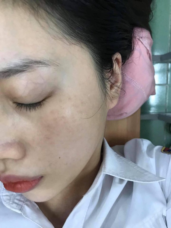 Skincare thời 4.0: Dùng đồ bình dân nhưng đầu tư máy chăm da “xịn sò”, cô nàng này tự trị sạch nám, tàn nhang và lấy lại làn da căng bóng - Ảnh 1.