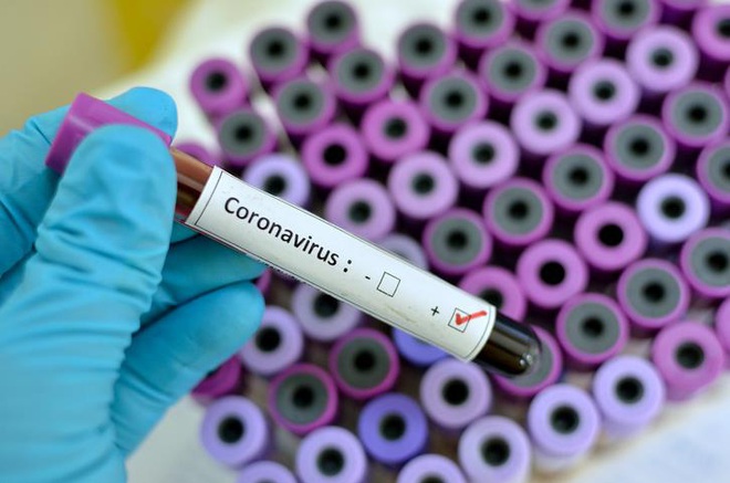 Nh&oacute;m nghi&ecirc;n cứu H&agrave; Lan t&igrave;m ra kh&aacute;ng thể chống virus corona  - Ảnh 1.
