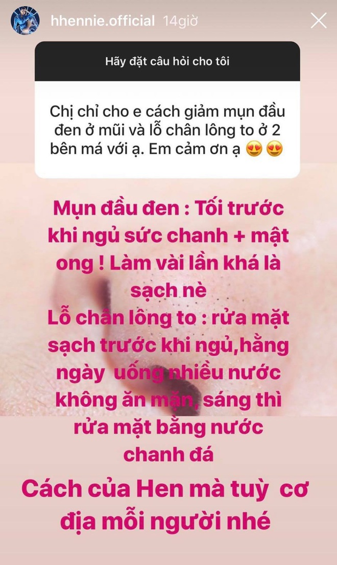 HHen Niê chỉ cách trị mụn đầu đen từ nguyên liệu rẻ bèo, nhưng lưu ý then chốt lại quên không nhắc tới - Ảnh 2.