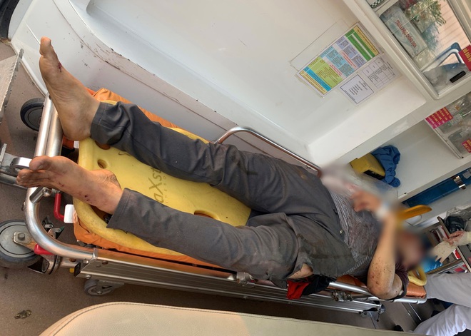 Nam thanh ni&ecirc;n đứng cạnh đường ray bị t&agrave;u hỏa t&ocirc;ng đứt l&igrave;a c&aacute;nh tay - Ảnh 1.