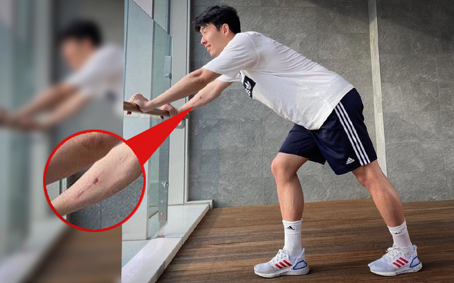 Son Heung-min gửi lời nhắn nhủ tới các fan trong lúc đang phải cách ly ở Hàn Quốc, nhìn cánh tay của anh chàng tất cả lại không khỏi xót xa - Ảnh 5.