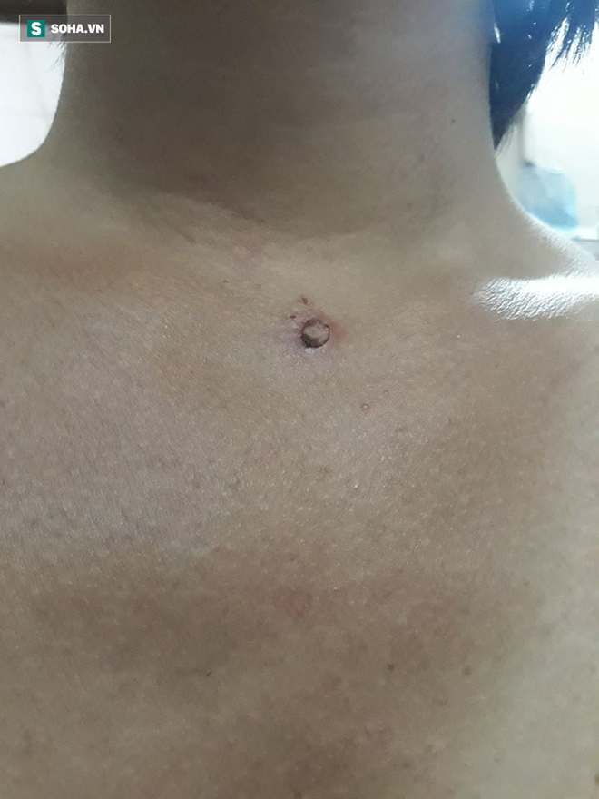 Chưởng môn võ Việt bóc mẽ bí mật ẩn sau màn công phu khoan vào thái dương, yết hầu - Ảnh 3.