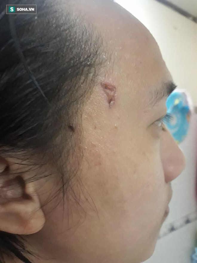 Chưởng môn võ Việt bóc mẽ bí mật ẩn sau màn công phu khoan vào thái dương, yết hầu - Ảnh 4.