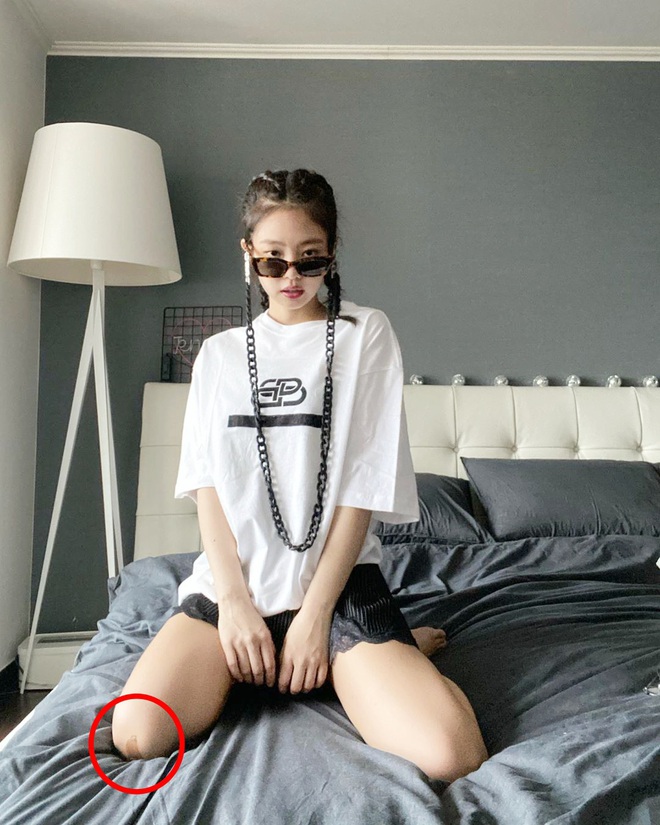Jennie khoe BST ảnh, fan vui mừng chưa được bao lâu thì lo sốt vó vì phát hiện dấu hiệu lạ trên chân của nữ idol - Ảnh 1.