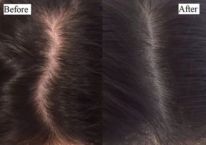 Xịt mọc tóc tinh dầu bưởi Cafuné kích thích mọc tóc dưỡng tóc giảm rụng  150ml