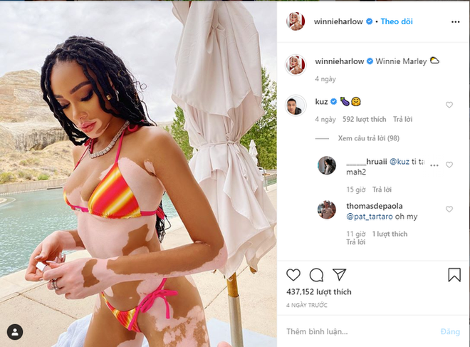 Lần đầu bị bắt gặp sánh bước cùng hotboy làng NBA, siêu mẫu bạch biến Winnie Harlow đã diện đồ bảo hộ nhưng vẫn bị một điểm trừ lớn - Ảnh 7.