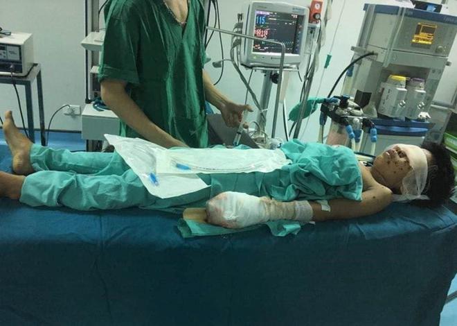  Thiếu ni&ecirc;n bị n&aacute;t tay, vỡ nh&atilde;n cầu cả 2 mắt sau tiếng nổ lớn  - Ảnh 1.