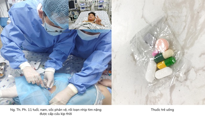 Mẹ tự &yacute; cho con trai uống thuốc đau họng khiến b&eacute; trai 11 tuổi sốc phản vệ rối loạn nhịp tim nặng, phải nhập viện cấp cứu - Ảnh 1.