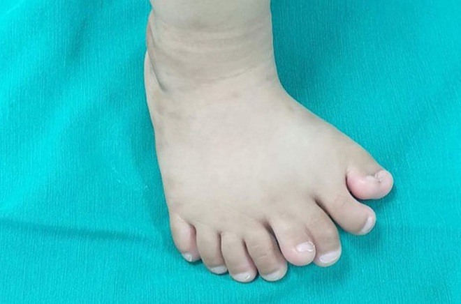  Kỳ lạ một b&eacute; trai c&oacute; tới 9 ng&oacute;n ch&acirc;n  - Ảnh 1.