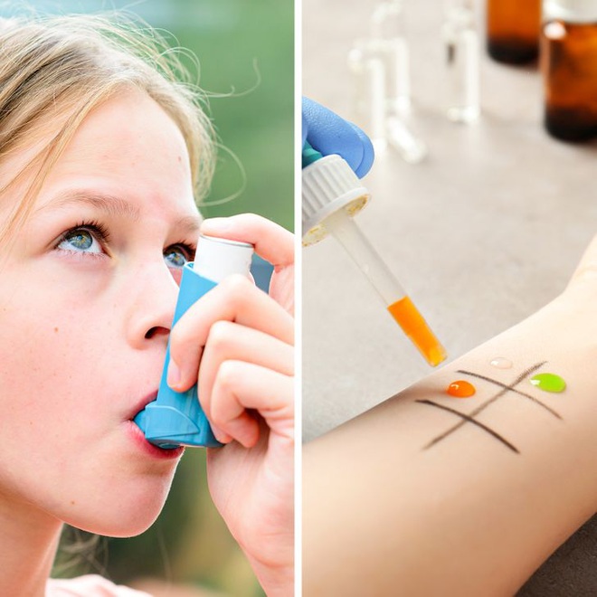 7 đặc điểm cho thấy con người ch&uacute;ng ta vẫn đang tiếp tục tiến h&oacute;a, nhưng n&oacute; kh&ocirc;ng tốt đẹp như bạn nghĩ đ&acirc;u - Ảnh 6.