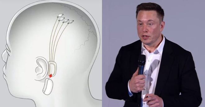 8 ý tưởng không thể điên rồ hơn của tỷ phú khác người Elon Musk - Ảnh 6.