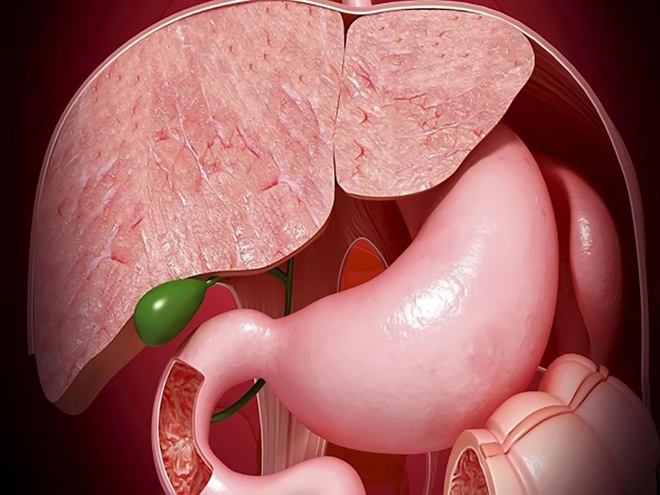 Polyp là gì? 4 bộ phận trong cơ thể nếu có polyp thì nguy cơ mắc bệnh ung thư là rất cao - Ảnh 2.