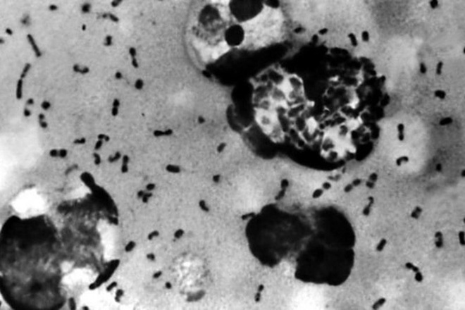 Trung Quốc phát hiện vi khuẩn dịch hạch tại 3 địa điểm ở Nội Mông Cổ - Ảnh 1.