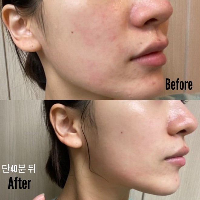 Th&agrave;nh phần si&ecirc;u sao trong cuộc đua chống gi&agrave;: Ngo&agrave;i Vit C, Retinol c&ograve;n 5 ứng vi&ecirc;n nữa m&agrave; bạn chưa biết tới - Ảnh 9.