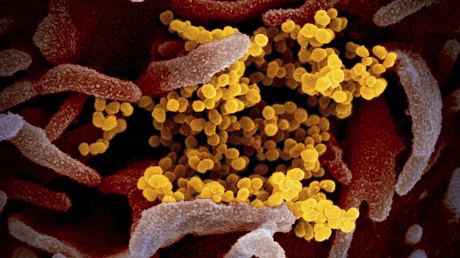B&eacute; g&aacute;i 6 tuổi người Mỹ tử vong do c&aacute;c biến chứng của virus SARS-CoV-2 - Ảnh 1.