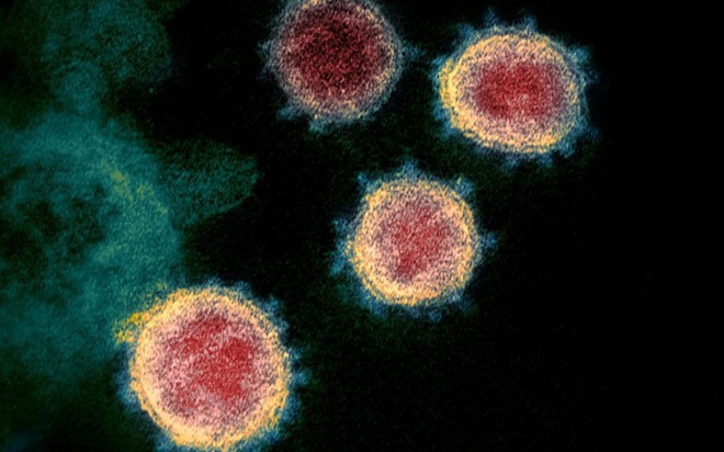Chủng virus SARS-CoV-2 gây Covid-19 tại Australia là loại dễ lây nhiễm - Ảnh 1.