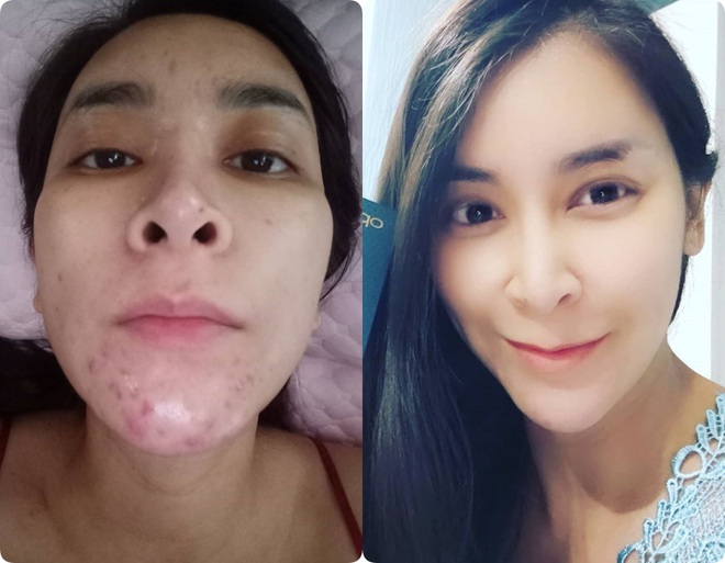 Chẳng phải Vit C hay Retinol, đây mới là thành phần mà mọi bác sĩ đều khuyên chị em nên dùng để có làn da sáng mịn như gái đôi mươi - Ảnh 3.