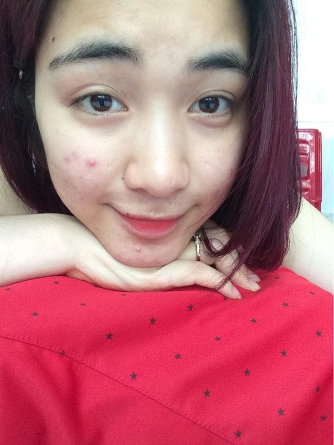 Bị tố &ldquo;dao k&eacute;o&rdquo;, Ho&agrave; Minzy tung lu&ocirc;n ảnh qu&aacute; khứ rồi tiện c&ocirc;ng khai lu&ocirc;n điểm duy nhất can thiệp thẩm mỹ - Ảnh 3.