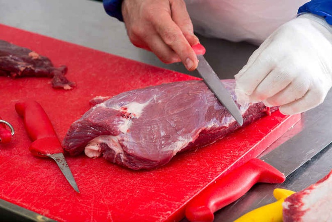 Chặt thịt lợn bằng tay trần, người phụ nữ sốt cao, bị viêm màng não do nhiễm liên cầu lợn - Ảnh 3.