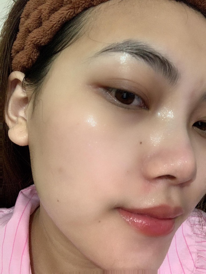 Từng nổi mụn vì skincare sai cách, cô nàng cải tổ da căng bóng nhờ loạt mặt nạ giấy chất lượng - Ảnh 3.