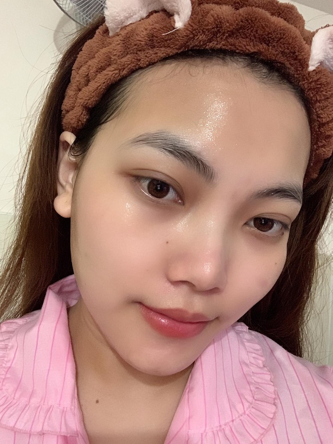 Từng nổi mụn vì skincare sai cách, cô nàng cải tổ da căng bóng nhờ loạt mặt nạ giấy chất lượng - Ảnh 2.