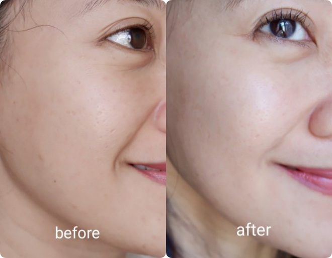 Da sạm hay thâm nám đến mấy cũng căng mịn, chỉ cần bạn chọn đúng 3 dòng retinol kiêm dưỡng ẩm vi diệu này - Ảnh 11.