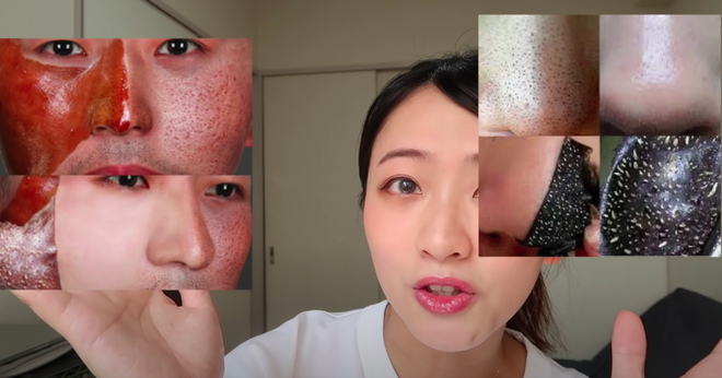 Beauty blogger người Nhật dạy cách trị mụn đầu đen ngay từ bước rửa mặt, nhấn mạnh lột mụn làm da lão hóa cực nhanh - Ảnh 3.