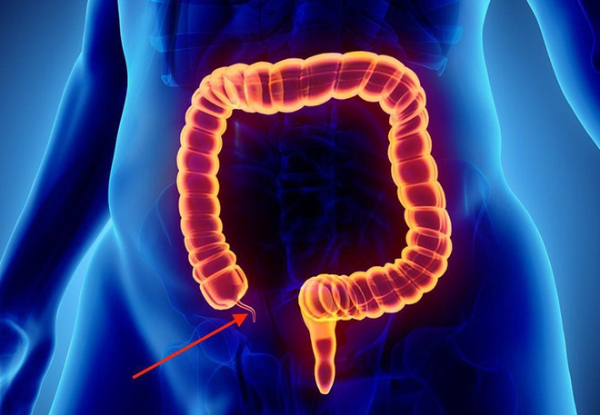 Bị đau tức vùng bụng dưới bên trái: nguyên nhân có thể là do 4 căn bệnh rình rập trong cơ thể - Ảnh 1.